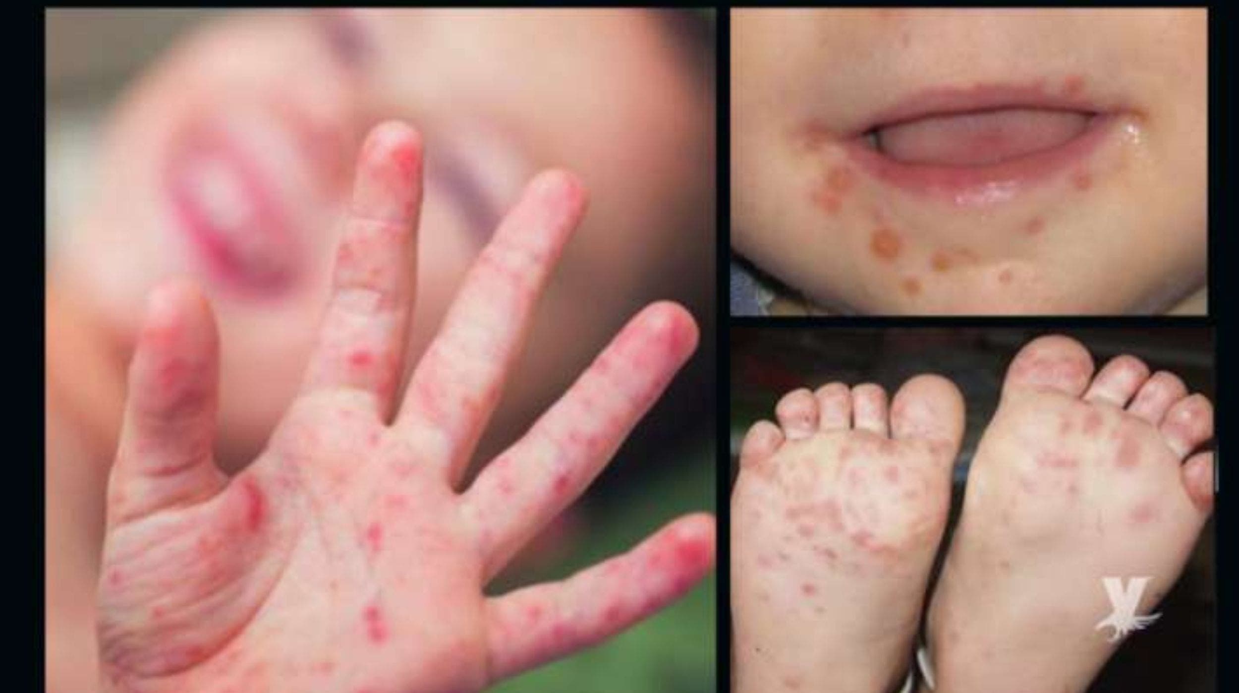 Suspenden clases en secundaria Antonio Caso de Cuautla por 5 casos de